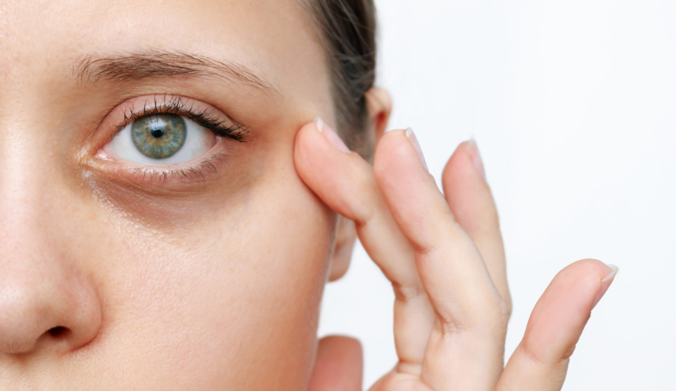 Advanced dermatology solutions targeting pigmentation, volume loss beneath the eyes, and eliminating dark eye circles