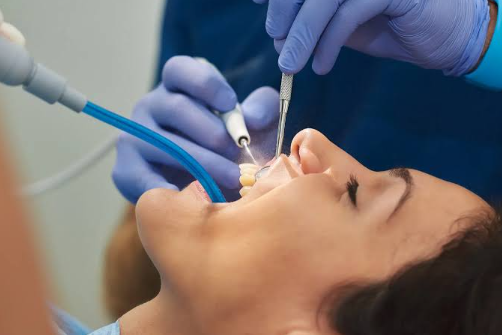Two Skipped Cleanings Cost More Than A Decade Of Checkups